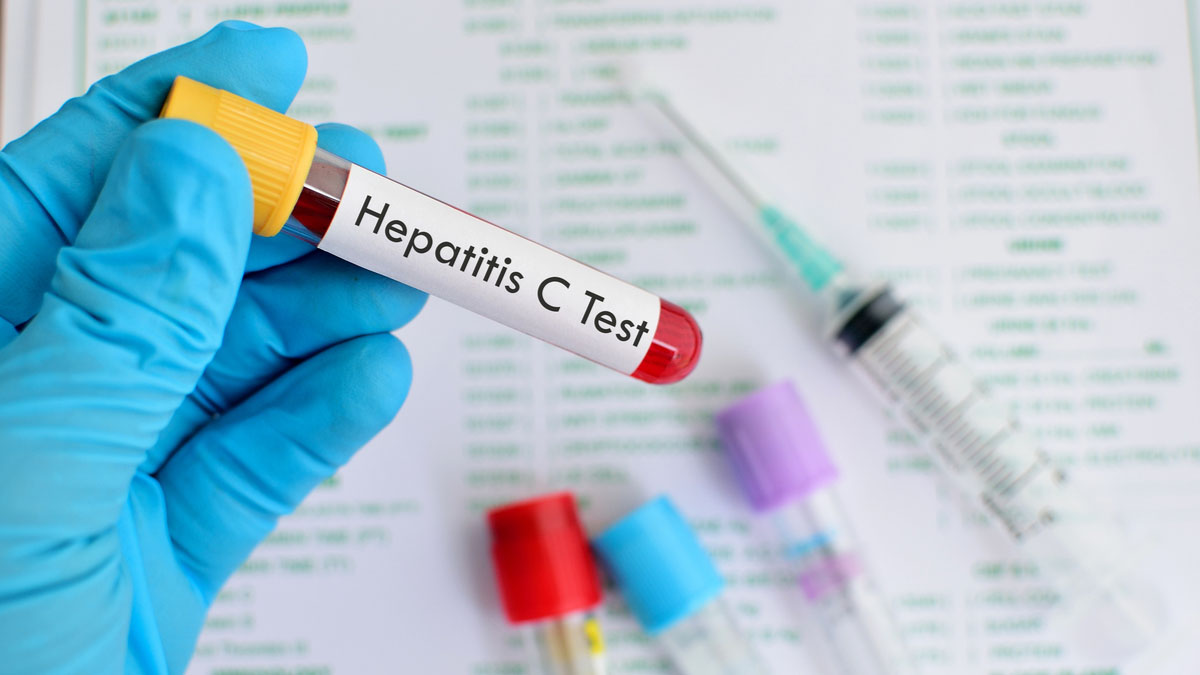 Hepatita C, o boala periculoasa, dar care poate fi tratata eficient